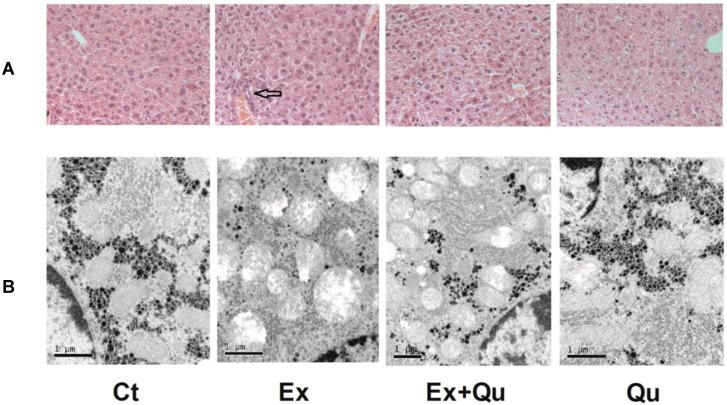 https://cdn.ncbi.nlm.nih.gov/pmc/blobs/851f/7551556/3c35ba2fabf7/nutrients-12-02770-g002.jpg