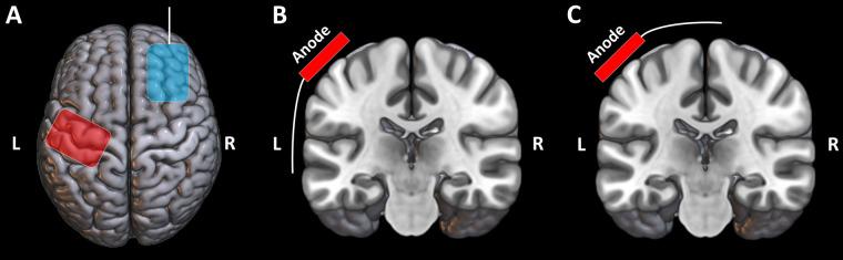 https://cdn.ncbi.nlm.nih.gov/pmc/blobs/8521/12206704/8c305553b50c/fpain-06-1533962-g001.jpg