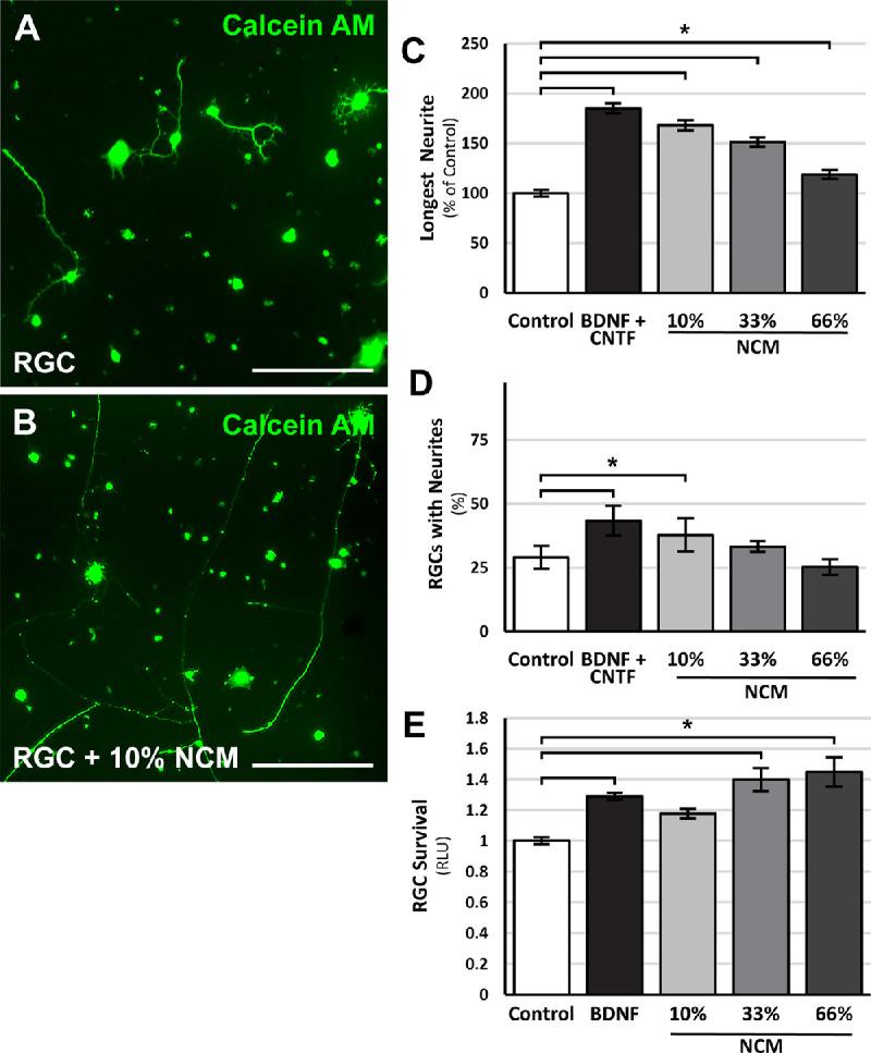 https://cdn.ncbi.nlm.nih.gov/pmc/blobs/8521/8300061/172a29b073a7/iovs-62-9-30-f002.jpg
