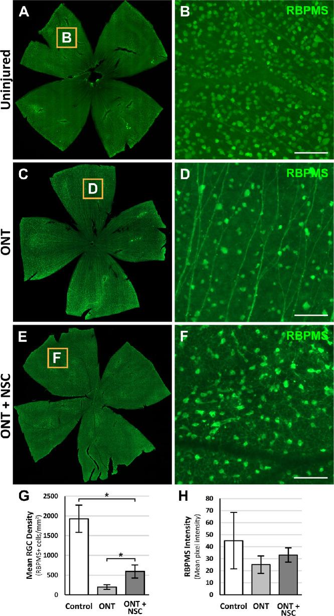 https://cdn.ncbi.nlm.nih.gov/pmc/blobs/8521/8300061/bb3b01eb927c/iovs-62-9-30-f003.jpg