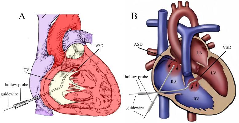 https://cdn.ncbi.nlm.nih.gov/pmc/blobs/8524/12059751/5f36c3d3b7b3/2153-8174-26-4-26279-g3.jpg