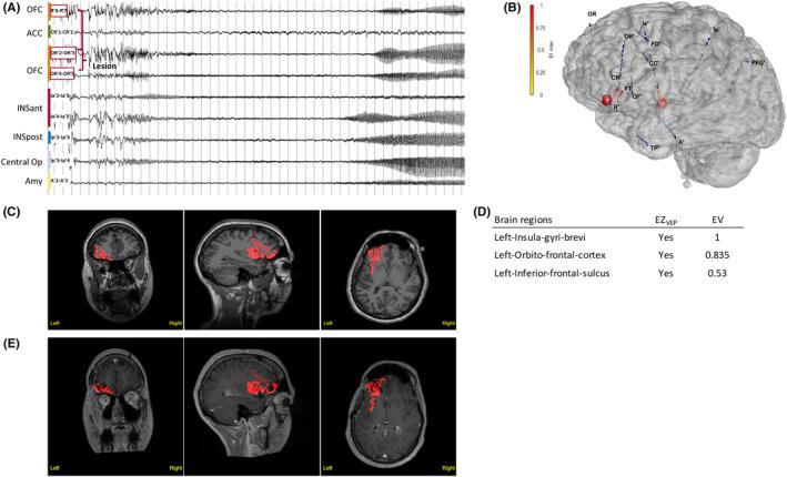 https://cdn.ncbi.nlm.nih.gov/pmc/blobs/8526/9543509/689f80fdef35/EPI-63-1942-g003.jpg