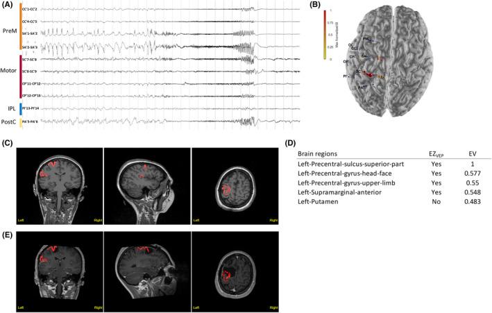 https://cdn.ncbi.nlm.nih.gov/pmc/blobs/8526/9543509/87592a8bddc2/EPI-63-1942-g005.jpg
