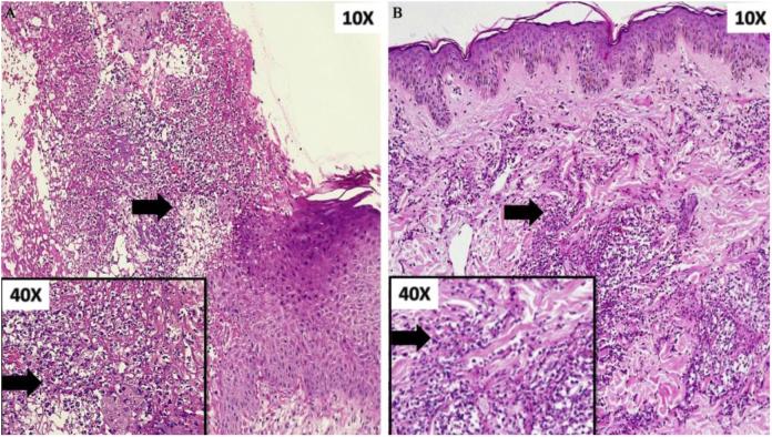 https://cdn.ncbi.nlm.nih.gov/pmc/blobs/852b/8007549/e22940bbad3d/gr3.jpg