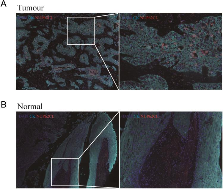 https://cdn.ncbi.nlm.nih.gov/pmc/blobs/8535/10474866/228eb137ec7a/JIR-16-3799-g0002.jpg