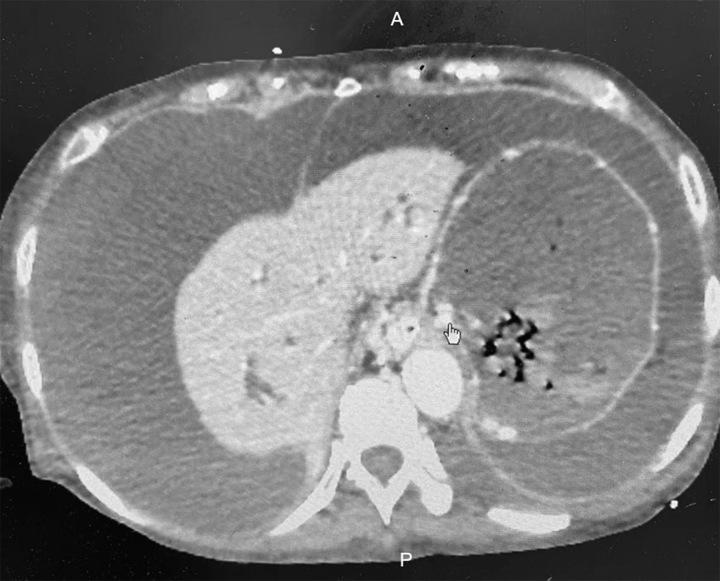 https://cdn.ncbi.nlm.nih.gov/pmc/blobs/853b/10783337/0ca49dc8dd17/ms9-86-485-g001.jpg