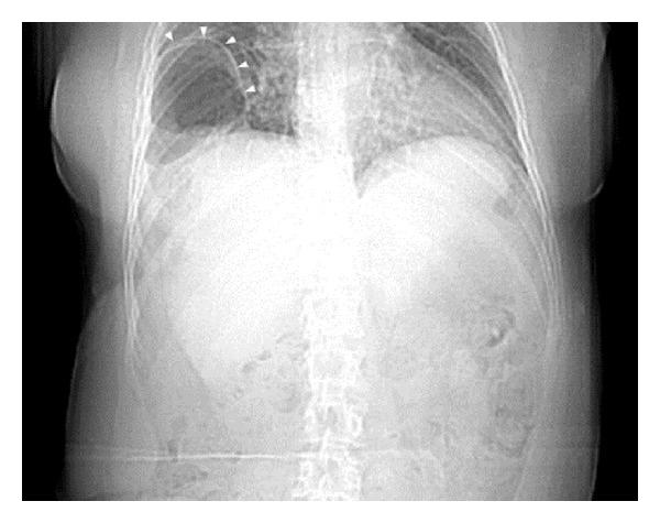https://cdn.ncbi.nlm.nih.gov/pmc/blobs/853f/4034723/4ff04a82502f/CRIS2014-949531.001.jpg