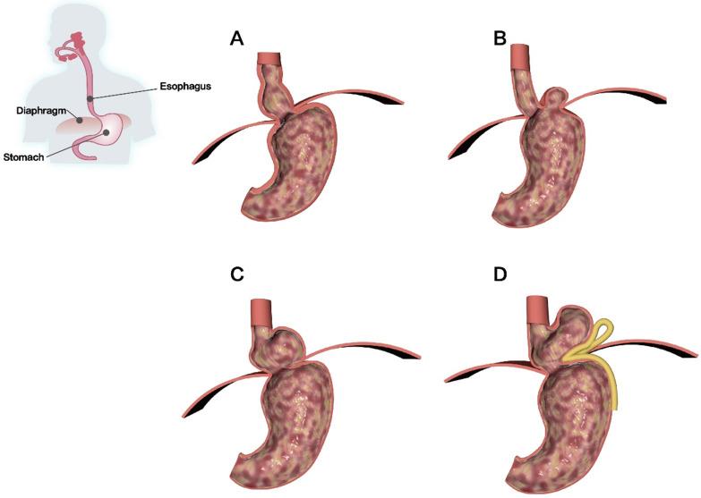 https://cdn.ncbi.nlm.nih.gov/pmc/blobs/8547/8579455/1b9618fb7f27/ijbsv17p4154g005.jpg