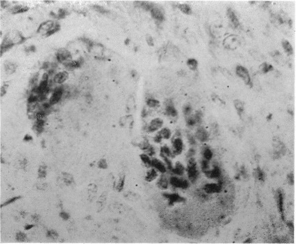 https://cdn.ncbi.nlm.nih.gov/pmc/blobs/8550/1406857/6f6f61dc43c1/annsurg00785-0091-a.jpg