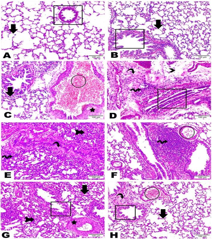 https://cdn.ncbi.nlm.nih.gov/pmc/blobs/8554/11920148/ca02db49088c/fphar-16-1522690-g006.jpg