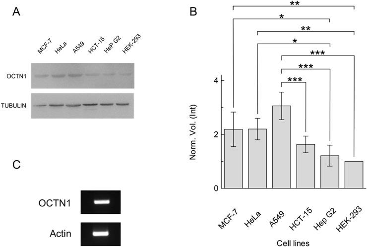 https://cdn.ncbi.nlm.nih.gov/pmc/blobs/8567/11666908/58bfd2111729/fmolb-11-1512530-g001.jpg