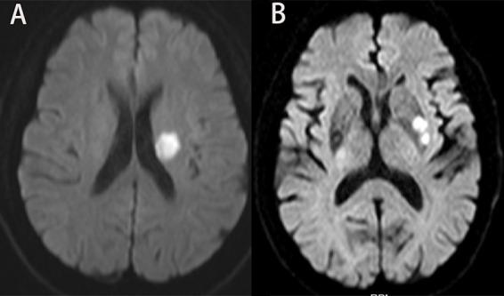https://cdn.ncbi.nlm.nih.gov/pmc/blobs/8567/11668809/2d3f70f5e791/fnins-18-1496810-g002.jpg