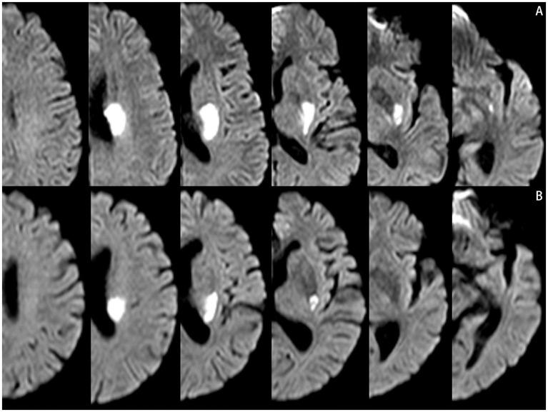 https://cdn.ncbi.nlm.nih.gov/pmc/blobs/8567/11668809/e186216c6b76/fnins-18-1496810-g001.jpg
