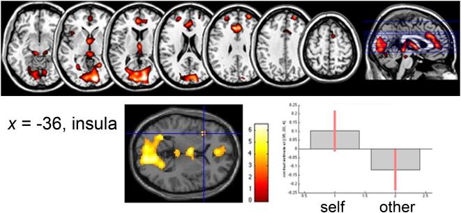 https://cdn.ncbi.nlm.nih.gov/pmc/blobs/8568/2643476/93235658c931/pone.0004618.g002.jpg