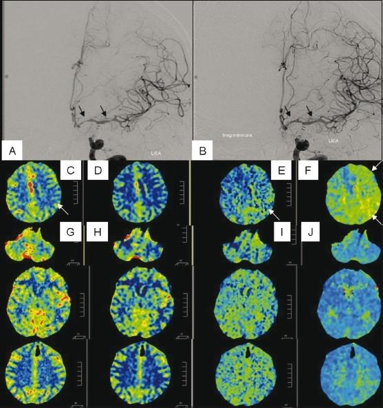 https://cdn.ncbi.nlm.nih.gov/pmc/blobs/856a/3190494/965b09413863/IJRI-21-209-g004.jpg