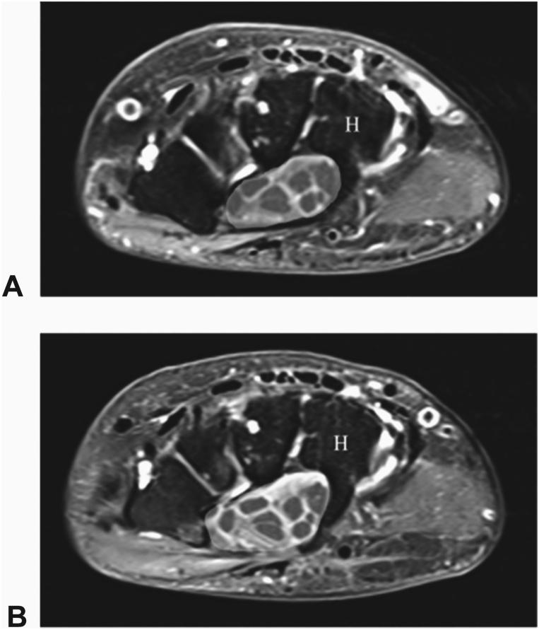 https://cdn.ncbi.nlm.nih.gov/pmc/blobs/856c/10543793/13809b25c334/gr4.jpg