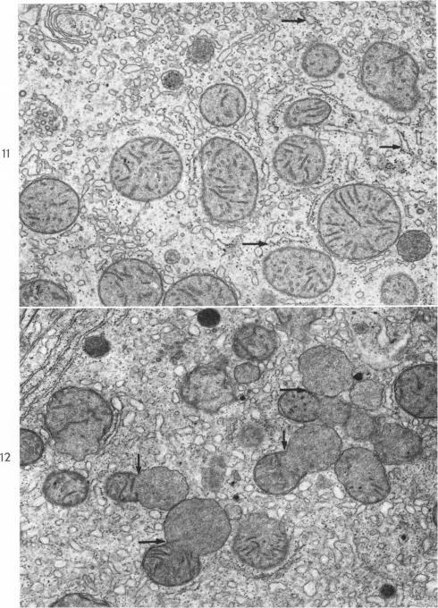 https://cdn.ncbi.nlm.nih.gov/pmc/blobs/8578/1907286/045c52d78351/amjpathol00277-0052-a.jpg