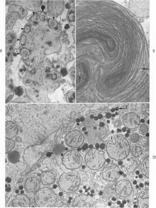 https://cdn.ncbi.nlm.nih.gov/pmc/blobs/8578/1907286/0eb854b97b94/amjpathol00277-0051-a.jpg