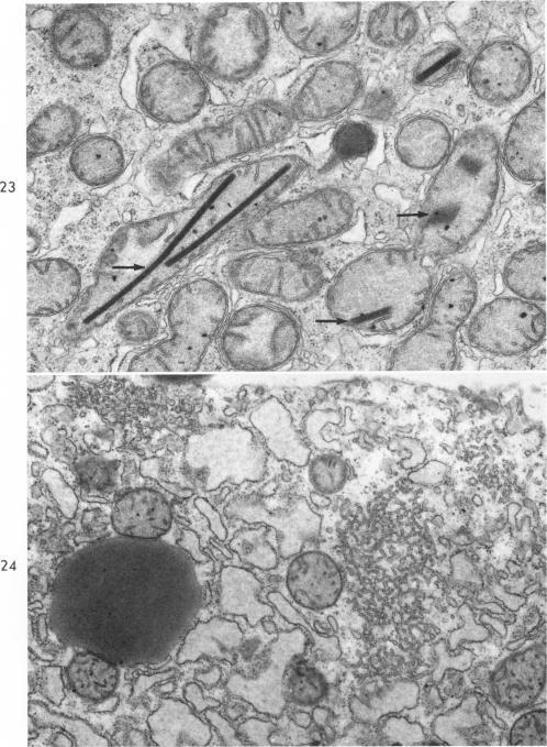 https://cdn.ncbi.nlm.nih.gov/pmc/blobs/8578/1907286/c9ac23308763/amjpathol00277-0058-a.jpg