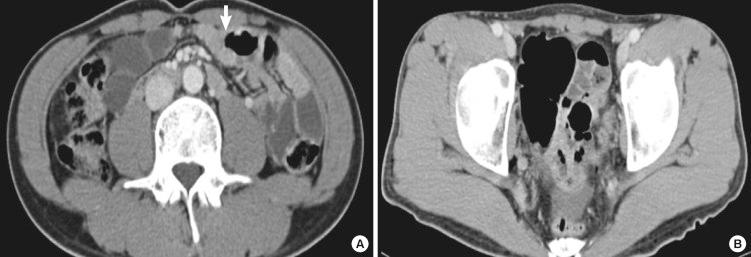 https://cdn.ncbi.nlm.nih.gov/pmc/blobs/8579/3492681/d6d7d0b59eec/jkms-27-1424-g001.jpg