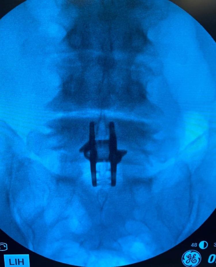 https://cdn.ncbi.nlm.nih.gov/pmc/blobs/857a/8713432/9f94fcd579db/cureus-0013-00000019956-i03.jpg