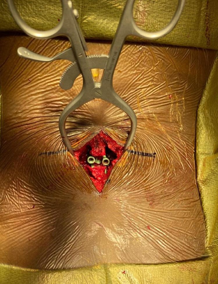 https://cdn.ncbi.nlm.nih.gov/pmc/blobs/857a/8713432/c8a47a7e59b6/cureus-0013-00000019956-i02.jpg
