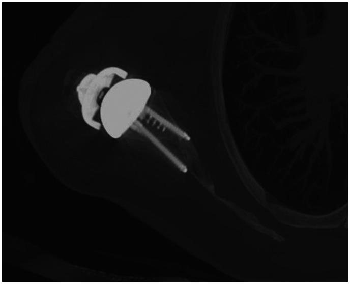 https://cdn.ncbi.nlm.nih.gov/pmc/blobs/8580/8282139/d85044bf79e8/10.1177_2471549220987714-fig4.jpg