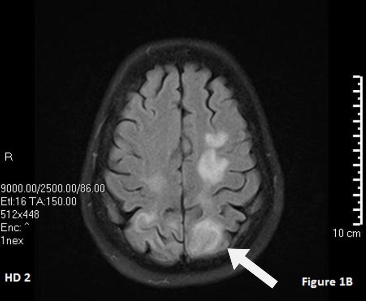 https://cdn.ncbi.nlm.nih.gov/pmc/blobs/8580/8942087/6a54dac6f27c/cureus-0014-00000022454-i02.jpg