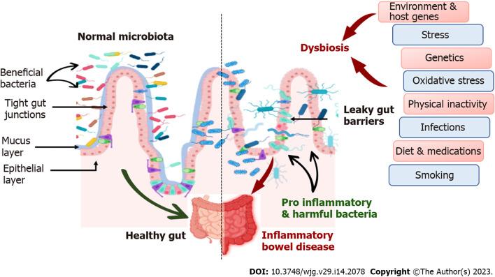 https://cdn.ncbi.nlm.nih.gov/pmc/blobs/8582/10130969/008aed1cc28d/WJG-29-2078-g001.jpg
