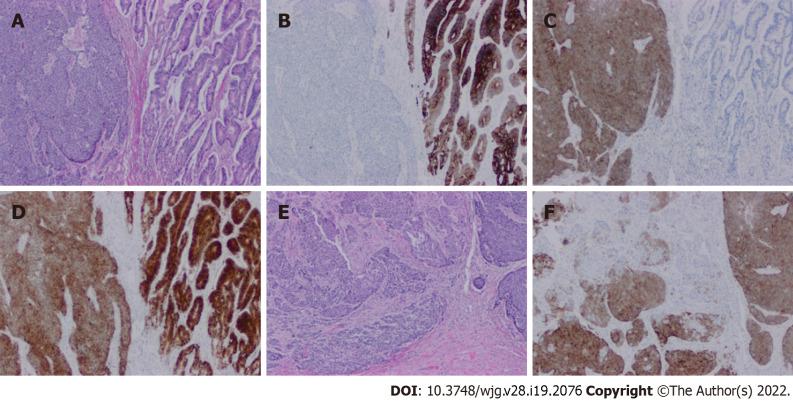 https://cdn.ncbi.nlm.nih.gov/pmc/blobs/8593/9134131/823631524e6e/WJG-28-2076-g004.jpg