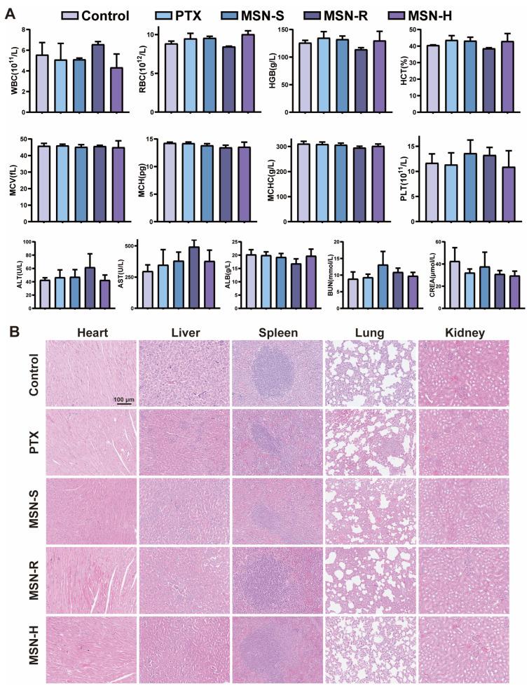 https://cdn.ncbi.nlm.nih.gov/pmc/blobs/859a/11125244/68631e531fa6/pharmaceutics-16-00632-g007.jpg