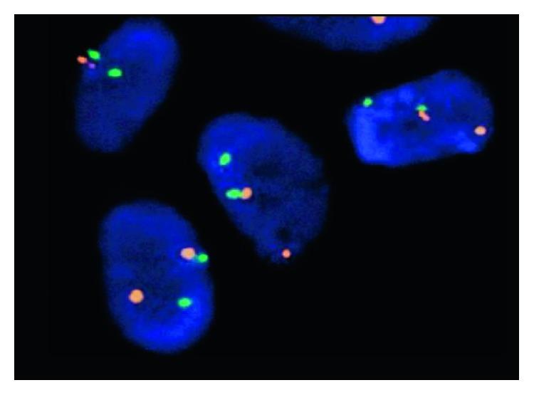 https://cdn.ncbi.nlm.nih.gov/pmc/blobs/85a0/6276405/c19fc23ad27a/CRIM2018-2313927.005.jpg