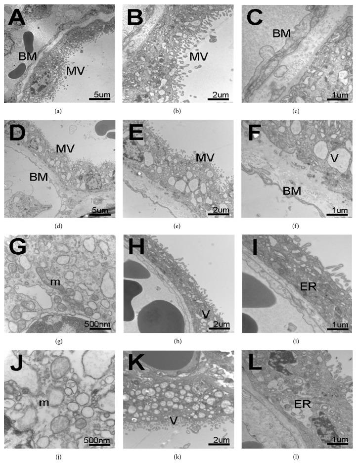 https://cdn.ncbi.nlm.nih.gov/pmc/blobs/85ad/4561319/1c9f4a20e252/OGI2015-283124.002.jpg