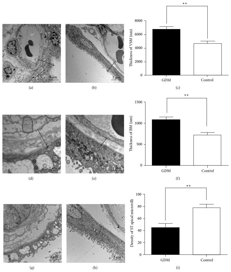 https://cdn.ncbi.nlm.nih.gov/pmc/blobs/85ad/4561319/7d1b89dfe181/OGI2015-283124.003.jpg