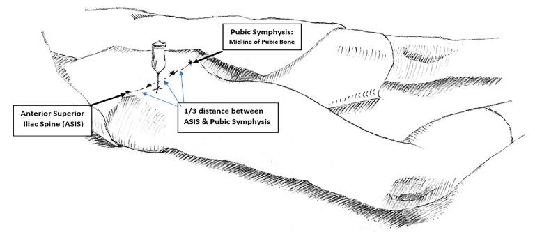 https://cdn.ncbi.nlm.nih.gov/pmc/blobs/85b0/6230372/d1ae332952a0/cpcem-02-286-g001.jpg