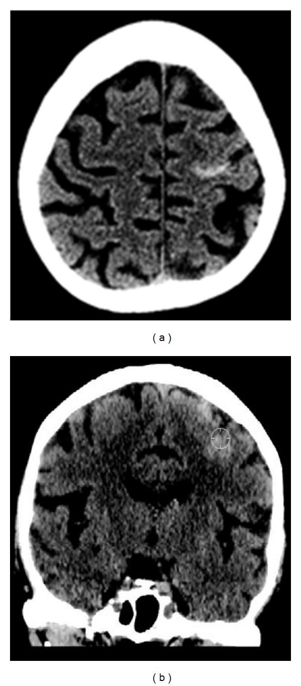 https://cdn.ncbi.nlm.nih.gov/pmc/blobs/85b1/3529902/7eea72765bb5/CRIM.RADIOLOGY2012-574849.001.jpg