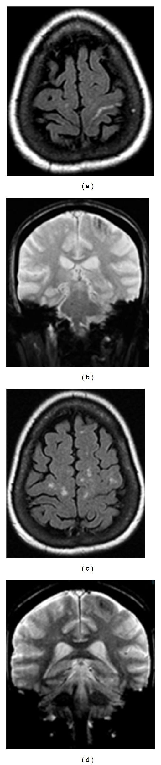 https://cdn.ncbi.nlm.nih.gov/pmc/blobs/85b1/3529902/7fc8f654e3c4/CRIM.RADIOLOGY2012-574849.004.jpg