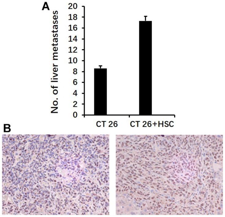 https://cdn.ncbi.nlm.nih.gov/pmc/blobs/85b6/6754330/185ac4b5a6cb/OTT-12-7573-g0007.jpg