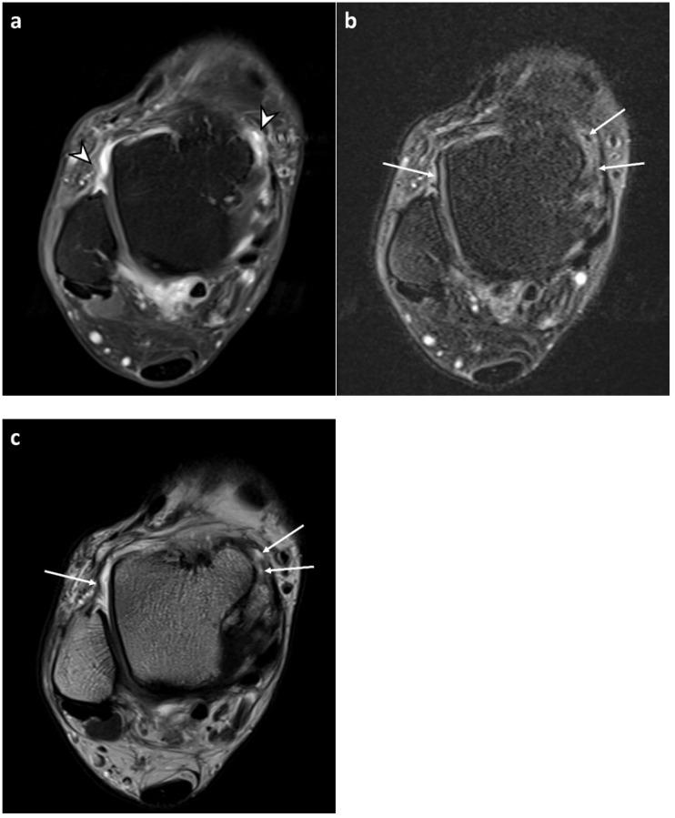 https://cdn.ncbi.nlm.nih.gov/pmc/blobs/85c2/10252366/d693b274f4e7/diagnostics-13-01960-g004.jpg