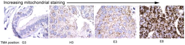 https://cdn.ncbi.nlm.nih.gov/pmc/blobs/85c3/3844930/7a5011b6b533/fonc-03-00292-g003.jpg