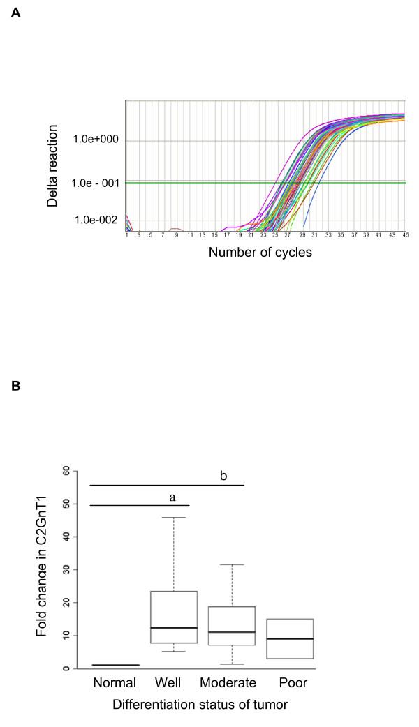 https://cdn.ncbi.nlm.nih.gov/pmc/blobs/85c7/2662873/88f2250ff3e6/1471-2407-9-79-7.jpg