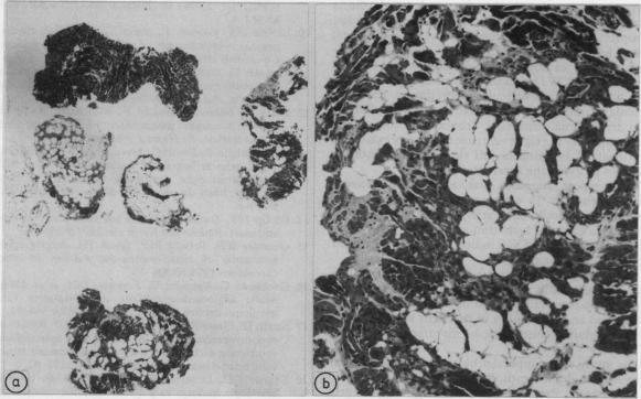 https://cdn.ncbi.nlm.nih.gov/pmc/blobs/85cb/1276897/2101c7c57750/brheartj00077-0057-a.jpg