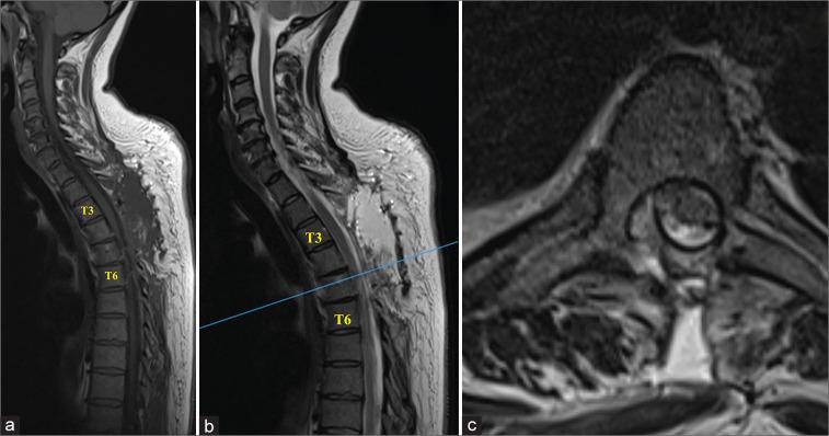 https://cdn.ncbi.nlm.nih.gov/pmc/blobs/85d4/10695466/b0ee7ca7ce2f/SNI-14-386-g002.jpg