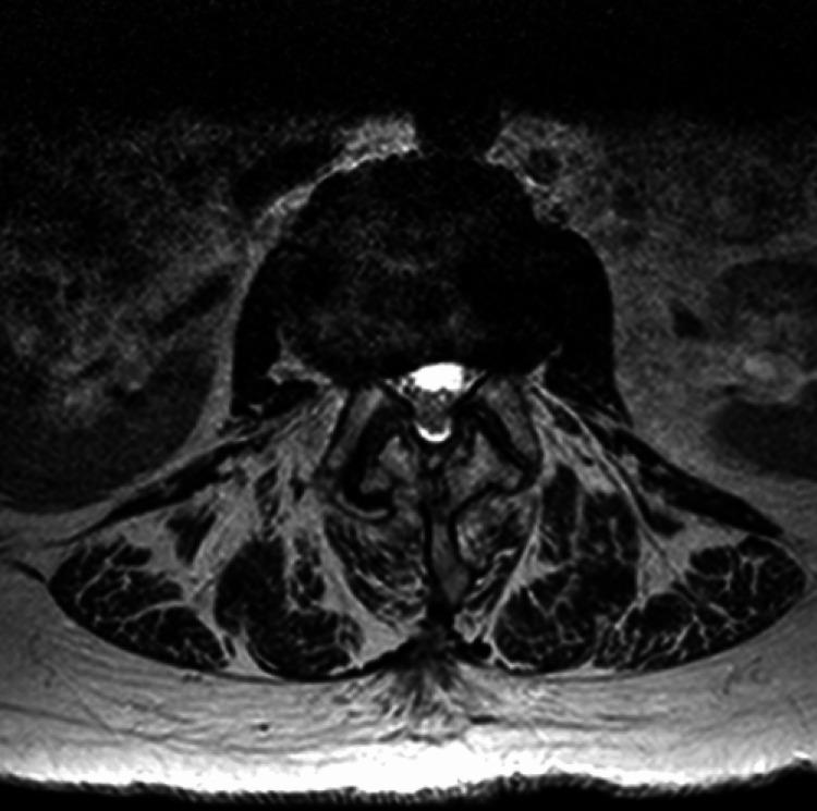 https://cdn.ncbi.nlm.nih.gov/pmc/blobs/85d6/11571276/b57cb56fdbf4/cureus-0016-00000071850-i02.jpg