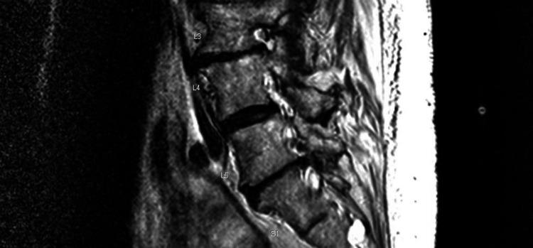 https://cdn.ncbi.nlm.nih.gov/pmc/blobs/85d6/11571276/f7f45c490947/cureus-0016-00000071850-i01.jpg