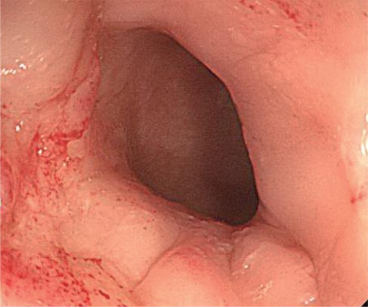 https://cdn.ncbi.nlm.nih.gov/pmc/blobs/85d7/3846998/1a130dbbaf57/kjim-28-715-g005.jpg