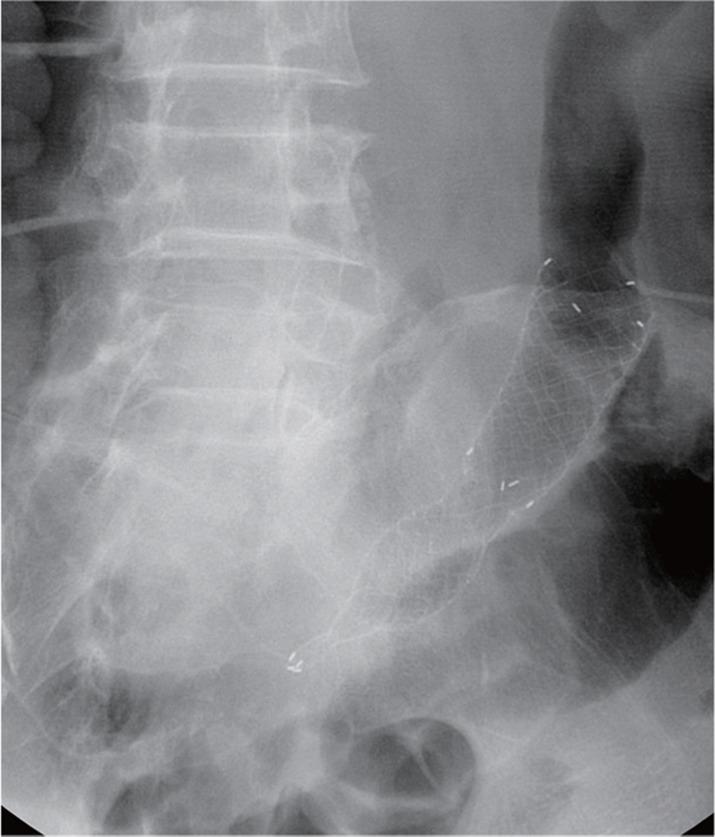 https://cdn.ncbi.nlm.nih.gov/pmc/blobs/85d7/3846998/4133106d6b94/kjim-28-715-g002.jpg