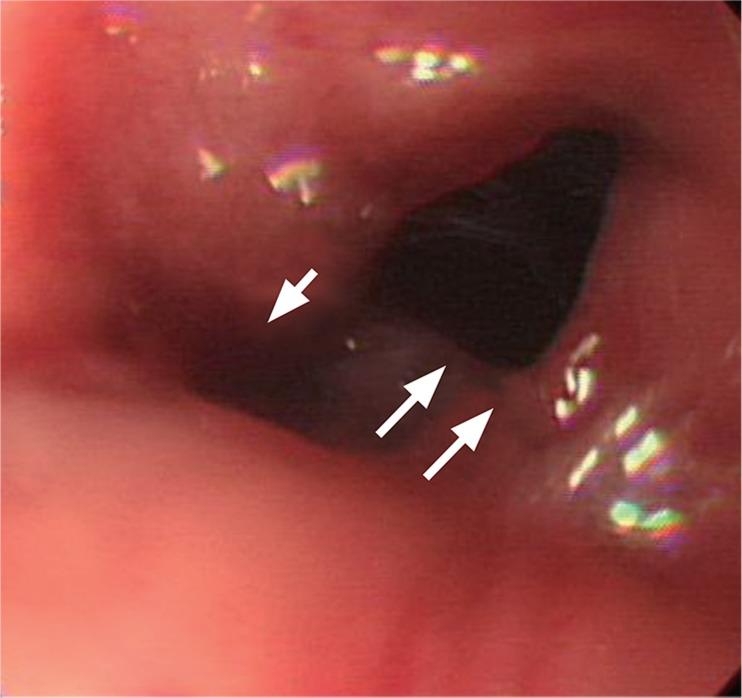 https://cdn.ncbi.nlm.nih.gov/pmc/blobs/85d7/3846998/d13e350fb67d/kjim-28-715-g001.jpg