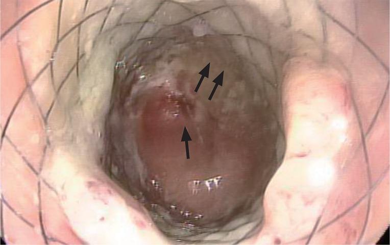 https://cdn.ncbi.nlm.nih.gov/pmc/blobs/85d7/3846998/f5048d6360d2/kjim-28-715-g004.jpg