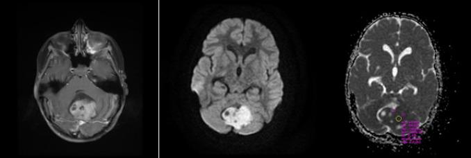 https://cdn.ncbi.nlm.nih.gov/pmc/blobs/85da/11781333/592e0a62400c/ijcn-19-055-g001.jpg